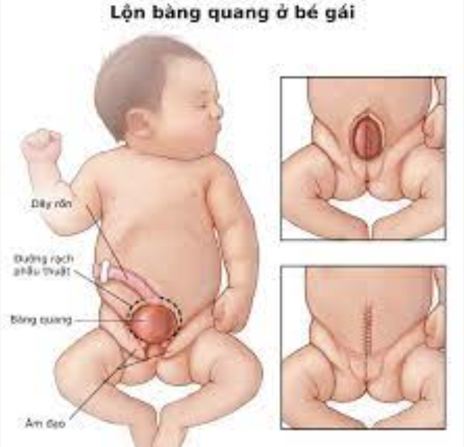 LỘ BÀNG QUANG