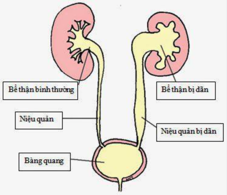 VAN NIỆU ĐẠO SAU